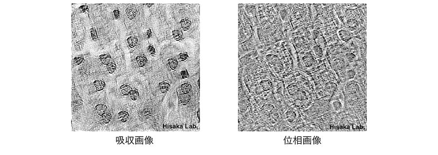 吸収画像と位相画像の図